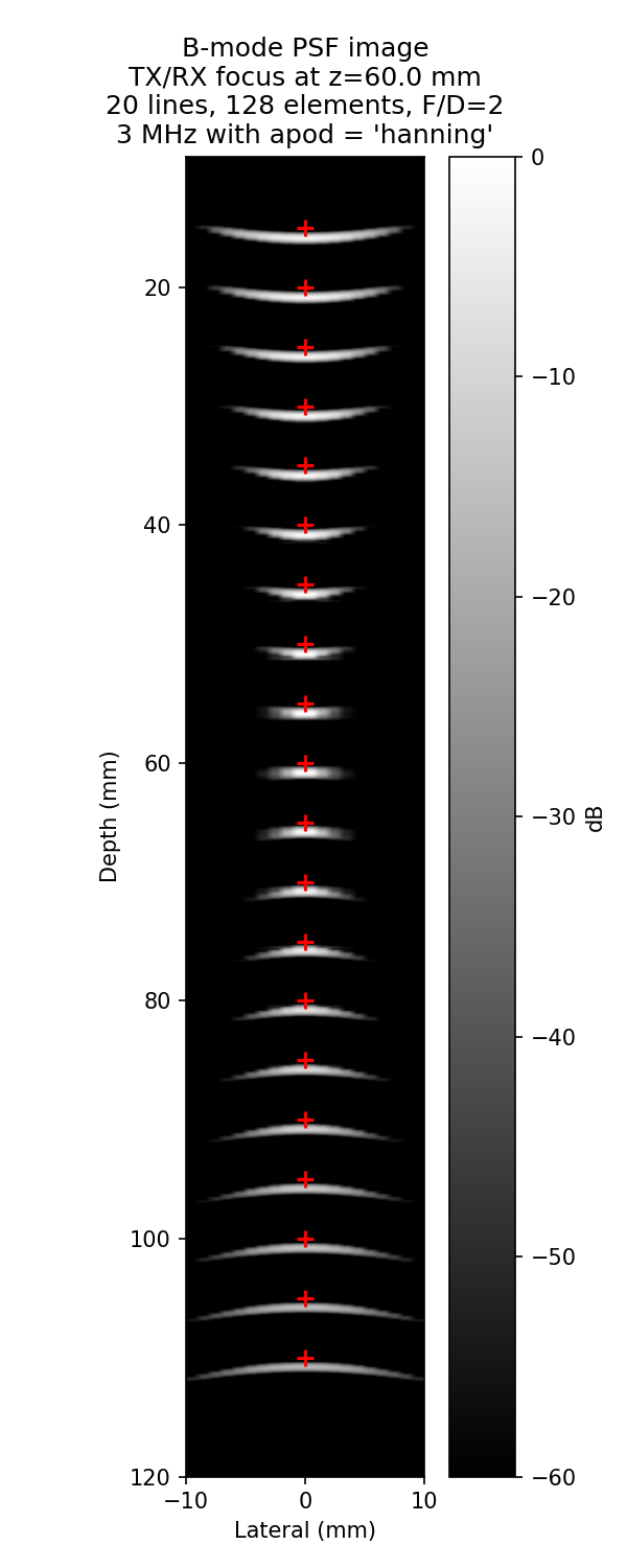B-mode PSF image
