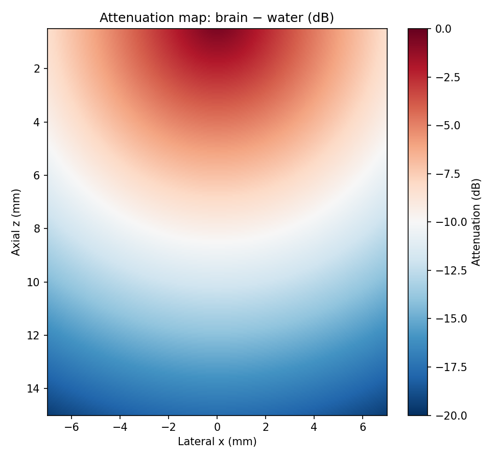Attenuation map (dB)