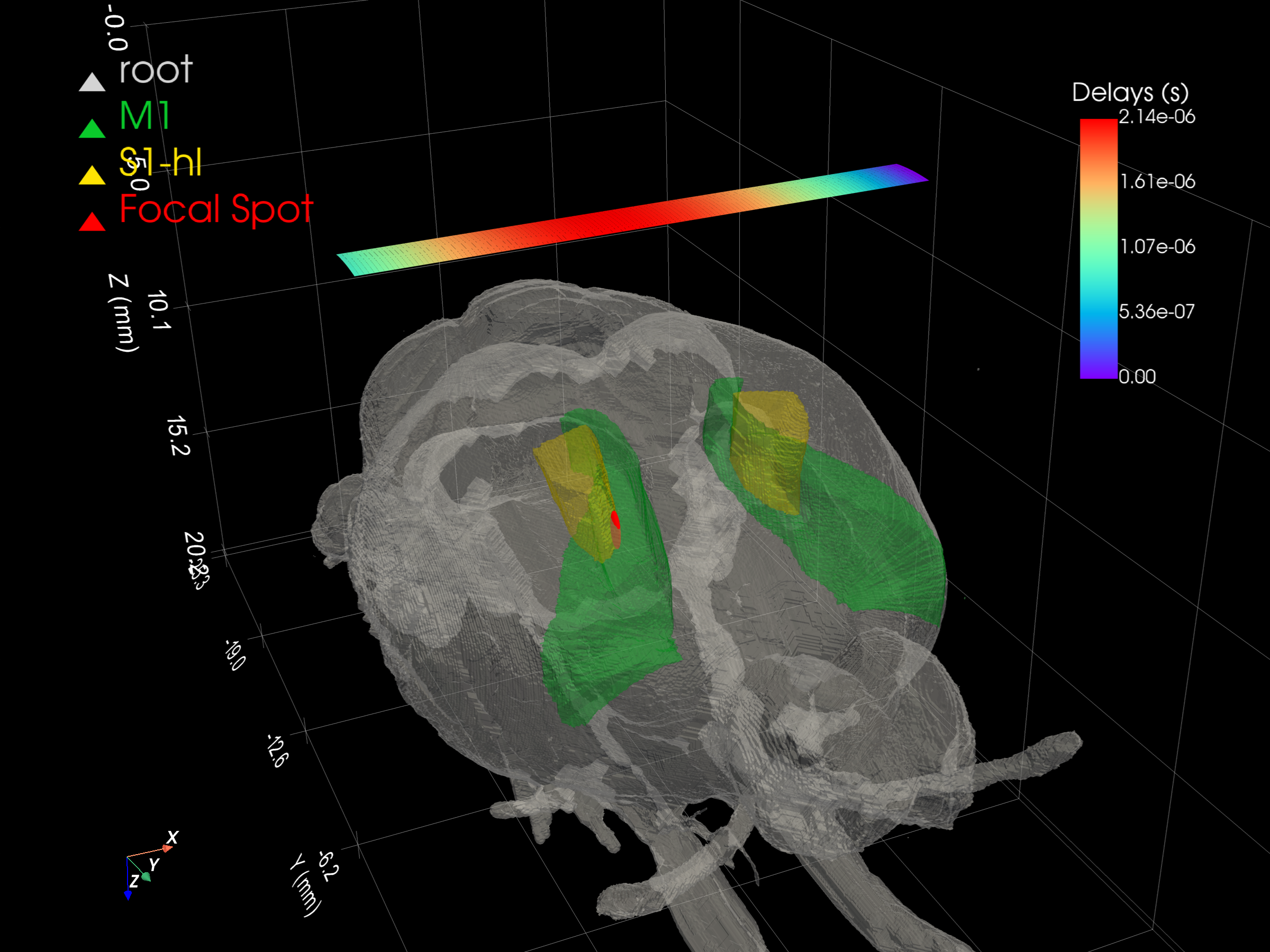 Rat brain zones with focused pressure field
