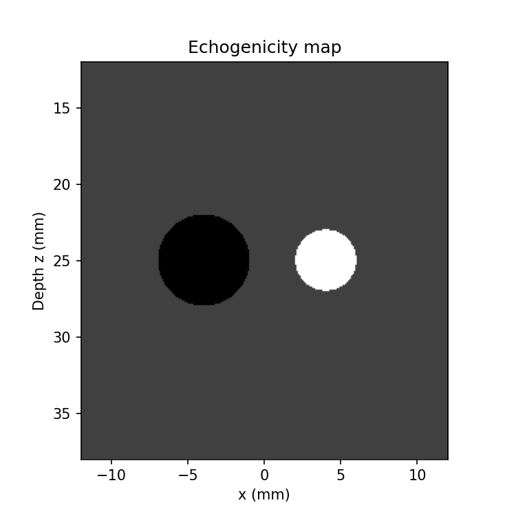 Echogenicity map