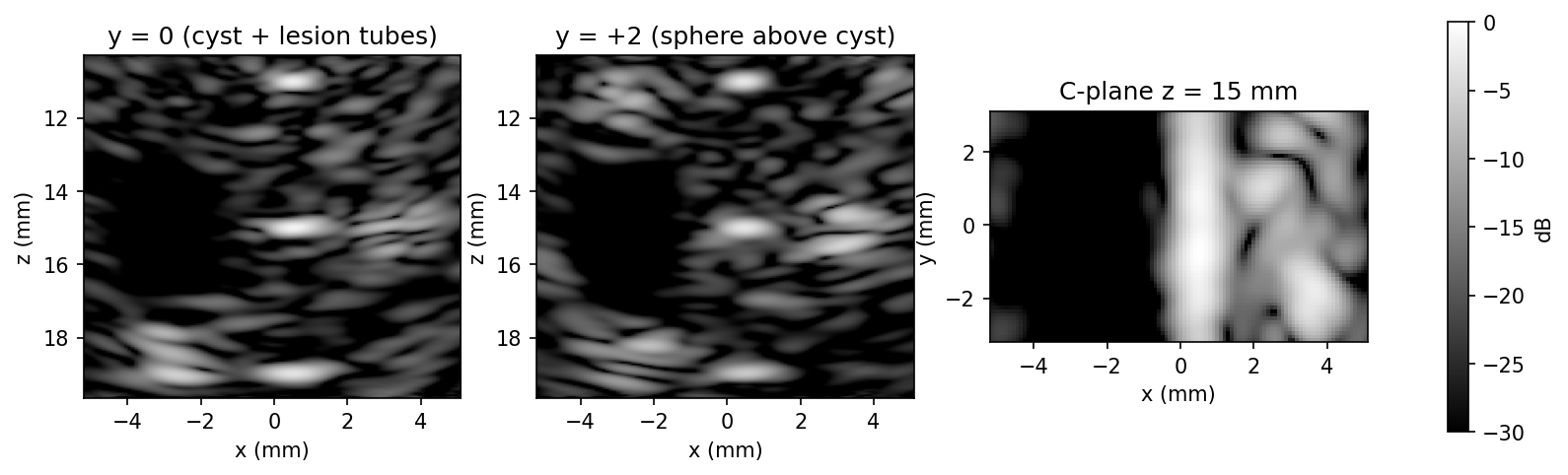 B-mode triptych